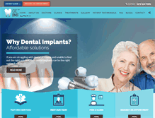 Tablet Screenshot of getimplant.com